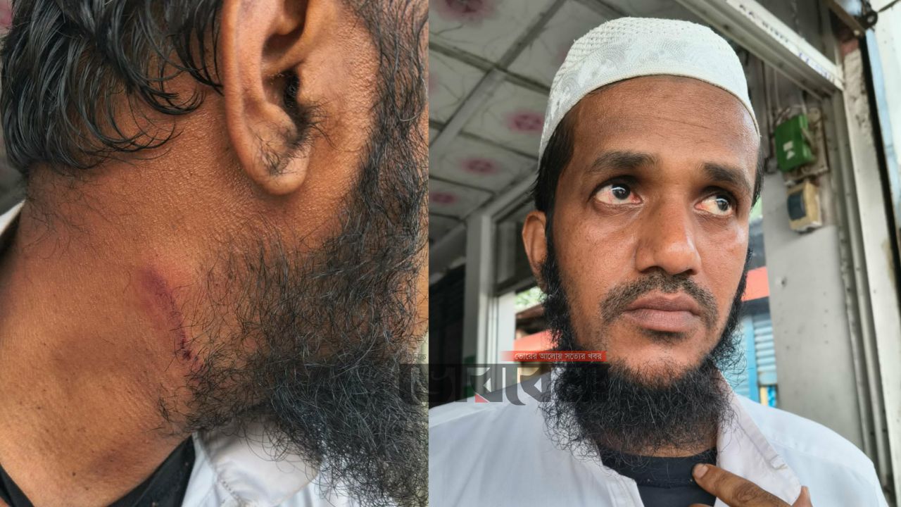 মসজিদের ইমামকে মারধর ও লাঞ্ছিত করার অভিযোগ