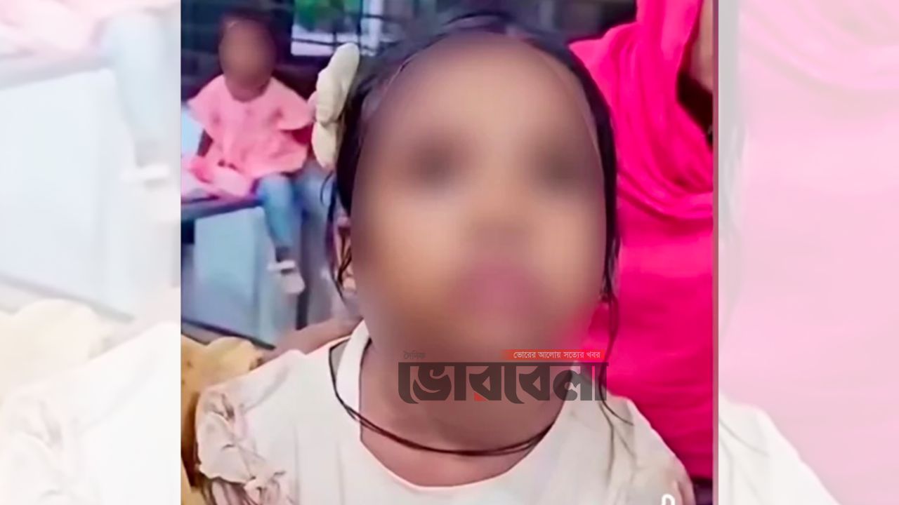 বিড়ালের আঁচড়ের পর শিশুর 'মিউ মিউ' শব্দ,আসল কারণ কী?